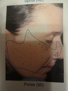 Pores