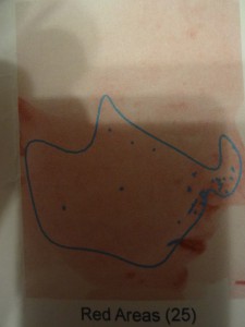Red Areas