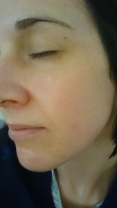 After a facial