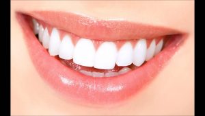 Good teeth